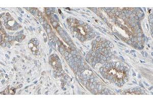 ABIN6276497 at 1/100 staining Human prostate tissue by IHC-P. (AMBRA1 抗体  (C-Term))