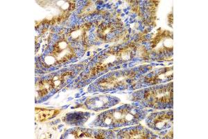 Immunohistochemistry of paraffin-embedded mouse Intestine using TNFSF11 antibody (ABIN6290161) at dilution of 1:100 (40x lens). (RANKL 抗体)