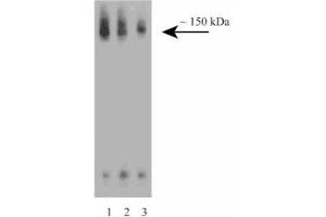 Western blot analysis of CD100 on a Jurkat cell lysate (Human T-cell leukemia, ATCC TIB-152). (SEMA4D/CD100 抗体  (AA 721-861))