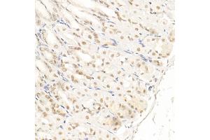 Immunohistochemistry of paraffin-embedded mouse stomach using SOCS1 Rabbit mAb (ABIN7270640) at dilution of 1:100 (40x lens). (SOCS1 抗体)