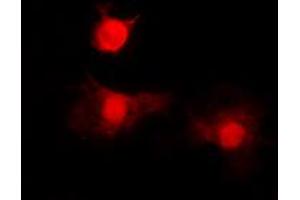 Immunofluorescence (IF) image for anti-Histone Deacetylase 8 (HDAC8) (N-Term), (pSer39) antibody (ABIN7299656)