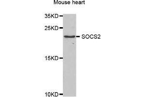Western blot analysis of extracts of mouse heart, using SOCS2 antibody. (SOCS2 抗体)