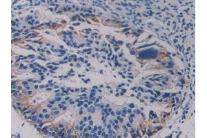 Used in DAB staining on fromalin fixed paraffin- embedded human liver tissue (CCL5 抗体  (AA 24-91))