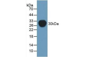 Detection of Recombinant Pgp, Mouse using Polyclonal Antibody to Permeability Glycoprotein (Pgp) (Permeability Glycoprotein 抗体  (AA 391-627))