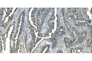 IHC analysis of Aspartate Aminotransferase/GOT1 using anti-Aspartate Aminotransferase/GOT1 antibody (ABIN7601883).