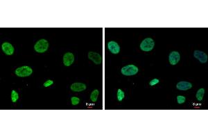 ICC/IF Image RecQ1 antibody [C1C3] detects RecQ1 protein at nucleus by immunofluorescent analysis.