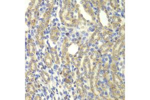 Immunohistochemistry of paraffin-embedded rat kidney using KBTBD7 antibody (ABIN5975133) at dilution of 1/100 (40x lens). (KBTBD7 抗体)