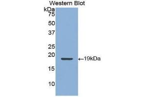 Western Blotting (WB) image for anti-Keratin 9 (KRT9) (AA 315-456) antibody (ABIN3208415) (KRT9 抗体  (AA 315-456))
