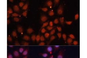 Immunofluorescence analysis of HeLa cells using CDK11B Polyclonal Antibody at dilution of 1:100. (CDK11 抗体)