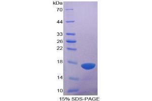SDS-PAGE analysis of Human ADAMTS1 Protein. (ADAMTS1 蛋白)