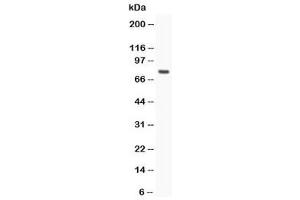 Western blot testing of hCG receptor antibody and MCF-7 lysate (hCG Receptor (N-Term) 抗体)