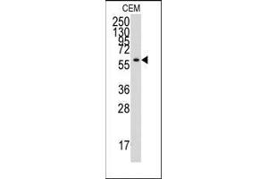 Western blot analysis of anti-YARS Antibody (C-term) in CEM cell line lysates (35ug/lane). (YARS 抗体  (C-Term))