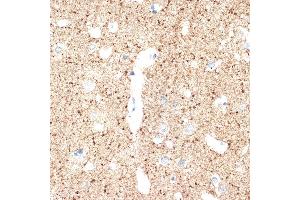 Immunohistochemistry of paraffin-embedded human brain using V Rabbit mAb (ABIN7271312) at dilution of 1:100 (40x lens).