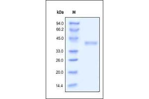 Human R-Spondin 1, His Tag on SDS-PAGE under reducing (R) condition. (RSPO1 Protein (AA 21-263) (His tag))