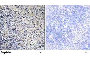 Immunohistochemistry analysis of paraffin-embedded human thymus gland tissue using TP53AIP1 polyclonal antibody .