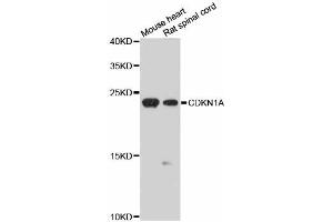 Western blot analysis of extracts of various cell lines, using CDKN1A antibody (ABIN5970693) at 1/1000 dilution. (p21 抗体)