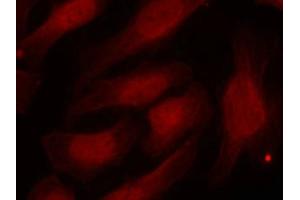Immunofluorescence staining of methanol-fixed Hela cells using Histone H2A. (H2AFX 抗体  (pSer139))