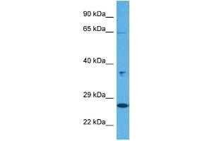 Host:  Rabbit  Target Name:  KL  Sample Tissue:  Human Jurkat Whole Cell  Antibody Dilution:  1ug/ml (Klotho 抗体  (N-Term))