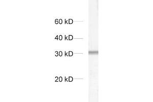 dilution: 1 : 1000, sample: crude synaptosomal fraction of rat brain (P2) (Syntaxin 6 抗体  (AA 1-235))