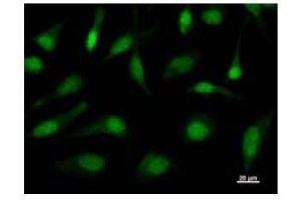 Immunofluorescence (IF) image for anti-TAF9B RNA Polymerase II, TATA Box Binding Protein (TBP)-Associated Factor, 31kDa (TAF9B) antibody (ABIN933163)