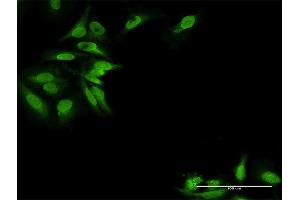 Immunofluorescence of purified MaxPab antibody to EPB41L2 on HeLa cell. (EPB41L2 抗体  (AA 1-633))