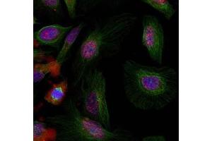 Image no. 3 for anti-Mdm2, p53 E3 Ubiquitin Protein Ligase Homolog (Mouse) (MDM2) (pSer166) antibody (ABIN401610) (MDM2 抗体  (pSer166))