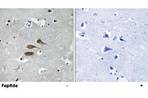 Immunohistochemistry analysis of paraffin-embedded human brain tissue using MARCH3 polyclonal antibody . (MARCH3 抗体)