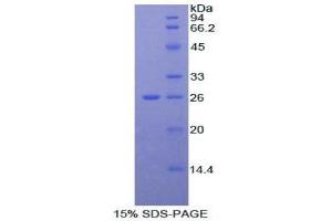 SDS-PAGE analysis of Mouse alpha Fodrin Protein. (SPTAN1 蛋白)