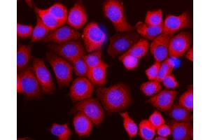 IF analysis of RPL10 using anti-RPL10 antibody (ABIN7601177). (RPL10 抗体  (AA 3-214))