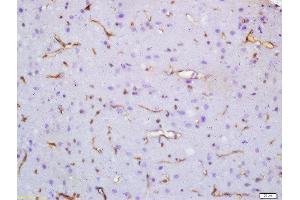 Formalin-fixed and paraffin embedded rat brain labeled with Anti-SV2A Polyclonal Antibody, Unconjugated  at 1:200 followed by conjugation to the secondary antibody and DAB staining (SV2A 抗体  (AA 451-550))