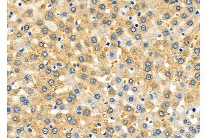 ABIN6264773 and ABIN6278630 at 1/100 staining Rat liver tissue by IHC-P. (URI1 抗体  (Internal Region))
