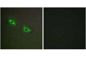 Immunofluorescence analysis of A549 cells, using Cytochrome P450 2S1 Antibody.