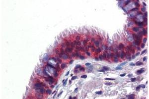 Human Lung, Respiratory Epithelium (formalin-fixed, paraffin-embedded) stained with BMPER antibody ABIN462252 followed by biotinylated goat anti-rabbit IgG secondary antibody ABIN481713, alkaline phosphatase-streptavidin and chromogen. (BMPER 抗体  (AA 501-550))