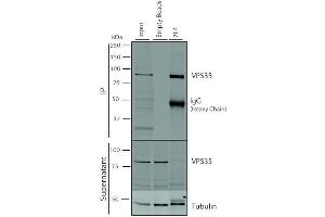 Immunoprecipitation analysis using Mouse Anti-VPS35 Monoclonal Antibody, Clone 7E4 (ABIN6932927). (VPS35 抗体  (HRP))