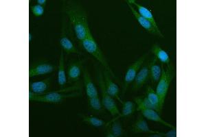 IF analysis of WDR1 using anti-WDR1 antibody (ABIN4886763). (WDR1 抗体  (C-Term))