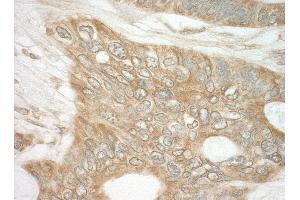 Immunohistochemistry (IHC) image for anti-Eukaryotic Translation Initiation Factor 4 gamma 2 (EIF4G2) (AA 125-175) antibody (ABIN7448949)