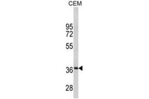 Western blot analysis of MPZ Antibody (C-term) in CEM cell line lysates (35ug/lane). (MPZ 抗体  (C-Term))