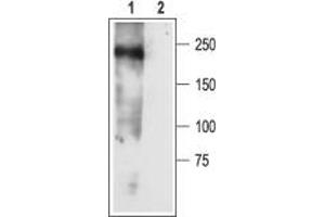 Western blot analysis of rat newborn brain membranes: - 1. (SCN3A 抗体  (Intracellular))