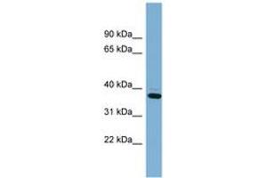 Image no. 1 for anti-XiAP Associated Factor 1 (XAF1) (AA 107-156) antibody (ABIN6742002) (XAF1 抗体  (AA 107-156))
