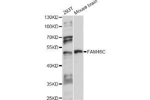 Western blot analysis of extracts of various cell lines, using FAM46C antibody (ABIN6292917) at 1:1000 dilution. (FAM46C 抗体)