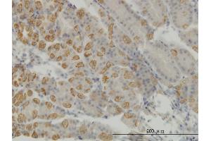 Immunoperoxidase of monoclonal antibody to AATK on formalin-fixed paraffin-embedded human stomach. (AATK 抗体  (AA 161-260))