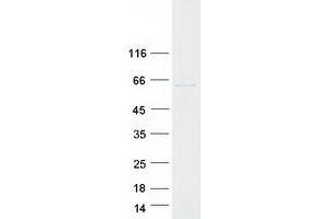 Western Blotting (WB) image for T-Complex 1 (TCP1) (Transcript Variant 1) protein (Myc-DYKDDDDK Tag) (ABIN2713332)