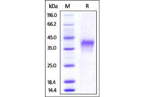Mouse 4-1BB, His Tag on SDS-PAGE under reducing (R) condition. (CD137 Protein (AA 24-211) (His tag))