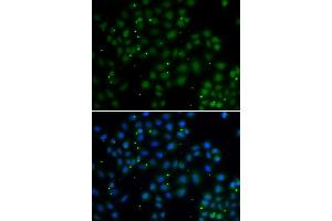 Immunofluorescence analysis of A549 cells using U2AF1L4 antibody (ABIN2560627).