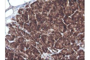 Image no. 3 for anti-Cancer/testis Antigen 1B (CTAG1B) antibody (ABIN1499895)
