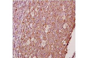 Immunohistochemistry analyzes of AP20378PU-N Ephrin-A1 antibody in paraffin-embedded human tonsil carcinoma tissue at 1/50. (Ephrin A1 抗体)