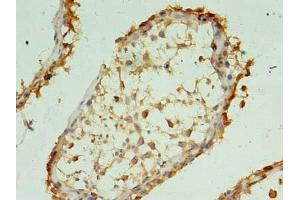 Immunohistochemistry of paraffin-embedded human testis tissue using ABIN7175875 at dilution of 1:100 (XAGE1 抗体  (AA 1-81))