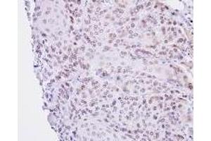 Immunohistochemistry: Lamin B2 antinbody staining of Paraffin-Embedded Cal27 Xenograft at 1/100 dilution. (Lamin B2 抗体  (AA 221-460))