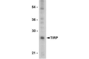 Image no. 1 for anti-Toll-Like Receptor Adaptor Molecule 2 (TICAM2) (C-Term) antibody (ABIN265137) (TICAM2 抗体  (C-Term))