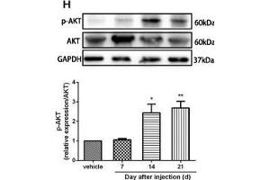 The CXCR7 and PI3K/Akt signaling pathways are involved in CPSP in the dorsal horn of the spinal cord. (GAPDH 抗体)